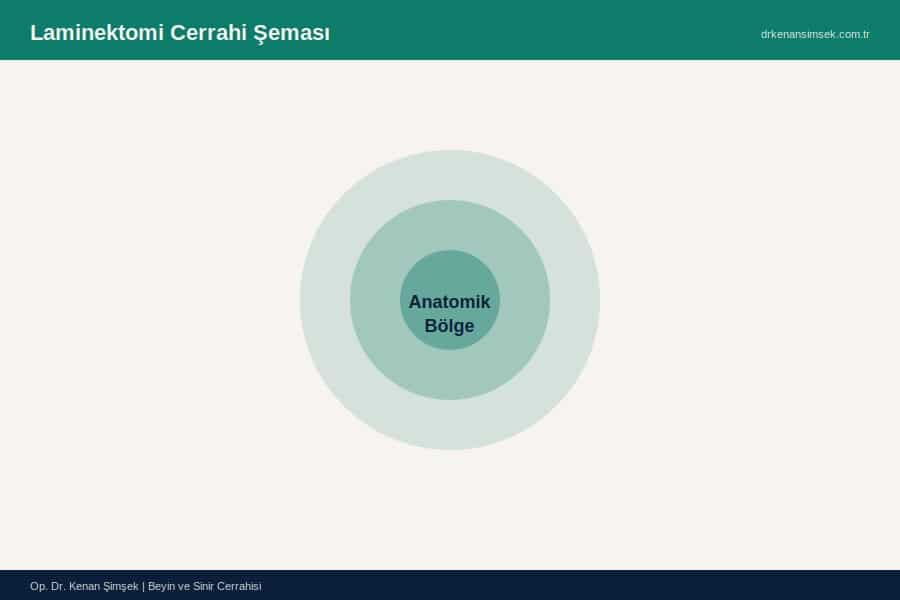 Laminektomi Cerrahi Şeması